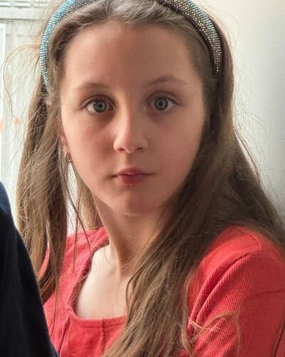 albina